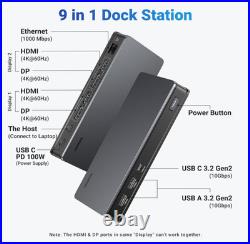 Ugreen Revodok 9 In 1 Pro Docking Station For Macbook Pro / Air Ugreen Revodok 9 In 1 Pro Docking Station For Macbook Pro / Air